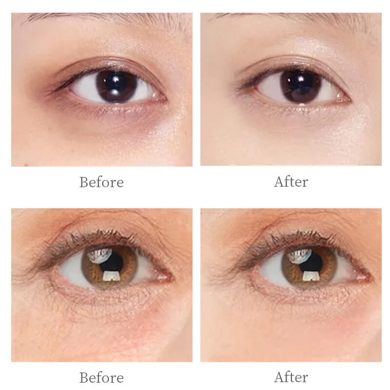 Eye cream polypeptide anti-aging remove eye bags reduce fine lines