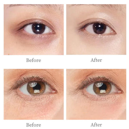 Eye cream polypeptide anti-aging remove eye bags reduce fine lines