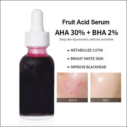 Face essence AHA fruit acid solution clean pore remove acne blackhead 30ml